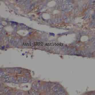 Anti-XRP2 antibody - Click Image to Close